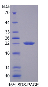 TRPM7 Protein - Recombinant Transient Receptor Potential Cation Channel Subfamily M, Member 7 By SDS-PAGE