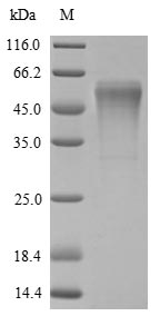 Trypsin-4 Protein - (Tris-Glycine gel) Discontinuous SDS-PAGE (reduced) with 5% enrichment gel and 15% separation gel.