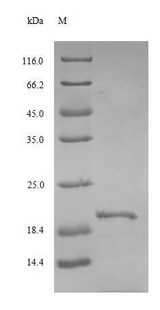 TSHB / TSH-Beta Protein - (Tris-Glycine gel) Discontinuous SDS-PAGE (reduced) with 5% enrichment gel and 15% separation gel.