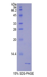 UCN2 / SRP Protein - Recombinant Urocortin 2 By SDS-PAGE