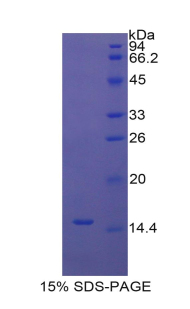 UCP1 / UCP-1 Protein - Recombinant Uncoupling Protein 1, Mitochondrial By SDS-PAGE