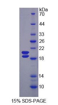 UMOD / Uromodulin Protein - Recombinant Uromodulin By SDS-PAGE