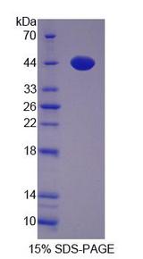 UROD Protein - Recombinant  Uroporphyrinogen Decarboxylase By SDS-PAGE