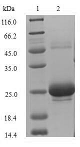 USAG1 / SOSTDC1 Protein - (Tris-Glycine gel) Discontinuous SDS-PAGE (reduced) with 5% enrichment gel and 15% separation gel.