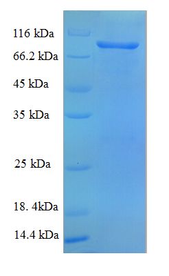 VCAM1 / CD106 Protein