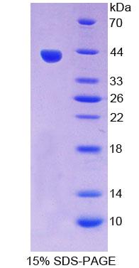 VCC-1 / CXCL17 Protein - Recombinant  VEGF Co Regulated Chemokine 1 By SDS-PAGE