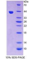 VCC-1 / CXCL17 Protein - Recombinant  VEGF Co Regulated Chemokine 1 By SDS-PAGE