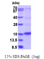 VEGFA / VEGF Protein