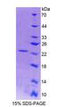 VHL / Von Hippel Lindau Protein - Recombinant  Von Hippel Lindau Tumor Suppressor By SDS-PAGE