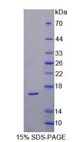 VIPR1 Protein - Recombinant  VasoactiveIntestinalPeptideReceptor1(VIPR1) By SDS-PAGE