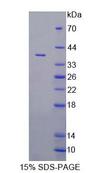 VNN1 Protein - Recombinant Vanin 1 (VNN1) by SDS-PAGE
