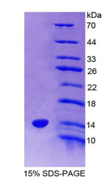 VPREB1 / CD179A Protein - Recombinant Pre-B-Lymphocyte Gene 1 By SDS-PAGE