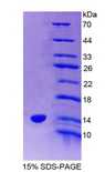 VPREB1 / CD179A Protein - Recombinant Pre-B-Lymphocyte Gene 1 By SDS-PAGE