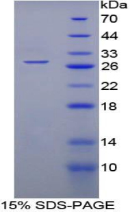 WARS Protein - Recombinant Tryptophanyl tRNA Synthetase By SDS-PAGE