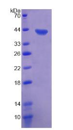XCL1 / Lymphotactin Protein - Recombinant Lymphotactin By SDS-PAGE