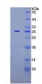 XPC Protein - Recombinant Xeroderma Pigmentosum, Complementation Group C By SDS-PAGE