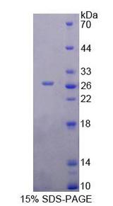 YAF2 Protein - Recombinant YY1 Associated Factor 2 By SDS-PAGE