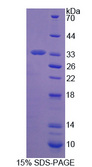 ZP2 Protein - Recombinant Zona Pellucida Glycoprotein 2, Sperm Receptor By SDS-PAGE
