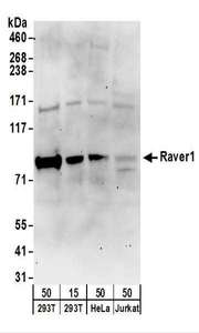 RAVER1 Antibody - Detection of Human Raver1 by Western Blot. Samples: Whole cell lysate from 293T (15 and 50 ug), HeLa (50 ug), and Jurkat (50 ug) cells. Antibodies: Affinity purified rabbit anti-Raver1 antibody used for WB at 1 ug/ml. Detection: Chemiluminescence with an exposure time of 3 minutes.