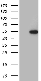 RAX / RX Antibody - HEK293T cells were transfected with the pCMV6-ENTRY control. (Left lane) or pCMV6-ENTRY RAX. (Right lane) cDNA for 48 hrs and lysed. Equivalent amounts of cell lysates. (5 ug per lane) were separated by SDS-PAGE and immunoblotted with anti-RAX. (1:2000)