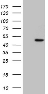 RAX / RX Antibody - HEK293T cells were transfected with the pCMV6-ENTRY control. (Left lane) or pCMV6-ENTRY RAX. (Right lane) cDNA for 48 hrs and lysed. Equivalent amounts of cell lysates. (5 ug per lane) were separated by SDS-PAGE and immunoblotted with anti-RAX. (1:2000)