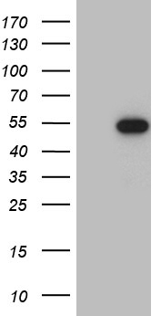 RAX / RX Antibody - HEK293T cells were transfected with the pCMV6-ENTRY control. (Left lane) or pCMV6-ENTRY RAX. (Right lane) cDNA for 48 hrs and lysed