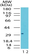 RAX / RX Antibody - Western blot of Rax in the 1) absence and 2) presence of immunizing peptide in Jurkat cell lysate using antibody at 0.5 ug/ml.