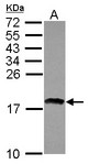 RAXL1 / RAX2 Antibody - Sample (30 ug of whole cell lysate) A: IMR32 12% SDS PAGE RAX2 / RAXL1 antibody diluted at 1:1000