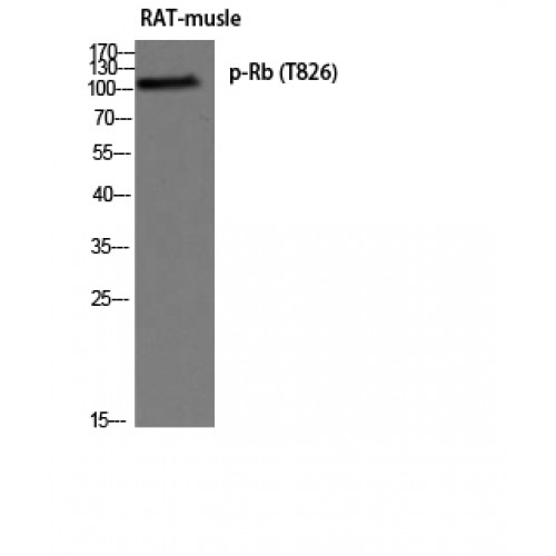 RB1 / Retinoblastoma / RB Antibody - Western blot of Phospho-Rb (T826) antibody