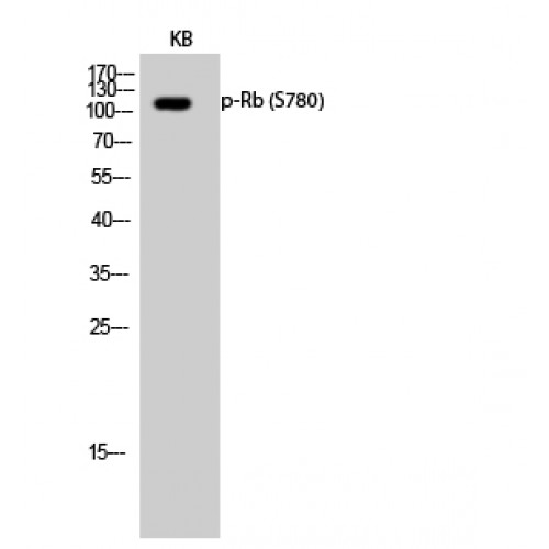 RB1 / Retinoblastoma / RB Antibody - Western blot of Phospho-Rb (S780) antibody