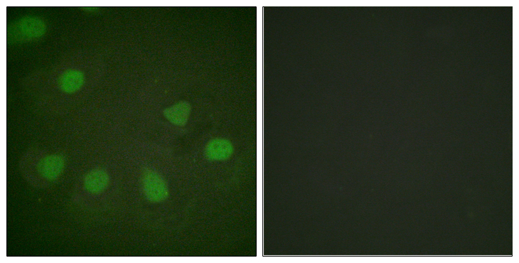 RB1 / Retinoblastoma / RB Antibody - Immunofluorescence analysis of HeLa cells, using Retinoblastoma Antibody. The picture on the right is blocked with the synthesized peptide.