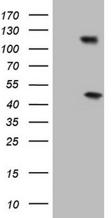 RB1 / Retinoblastoma / RB Antibody - Human recombinant protein fragment corresponding to amino acids 309-590 of human RB1 (NP_000312) produced in E.coli.