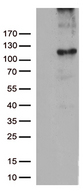 RB1 / Retinoblastoma / RB Antibody - HEK293T cells were transfected with the pCMV6-ENTRY control. (Left lane) or pCMV6-ENTRY RB1. (Right lane) cDNA for 48 hrs and lysed. Equivalent amounts of cell lysates. (5 ug per lane) were separated by SDS-PAGE and immunoblotted with anti-RB1. (1:2000)