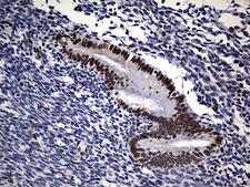 RB1 / Retinoblastoma / RB Antibody - Immunohistochemical staining of paraffin-embedded Human endometrium tissue within the normal limits using anti-RB1 mouse monoclonal antibody. (Heat-induced epitope retrieval by 1mM EDTA in 10mM Tris buffer. (pH8.5) at 120°C for 3 min. (1:500)