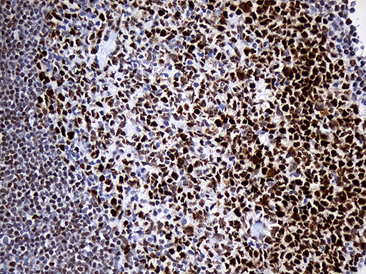 RB1 / Retinoblastoma / RB Antibody - Immunohistochemical staining of paraffin-embedded Human tonsil within the normal limits using anti-RB1 mouse monoclonal antibody. (Heat-induced epitope retrieval by 1mM EDTA in 10mM Tris buffer. (pH8.5) at 120°C for 3 min. (1:500)