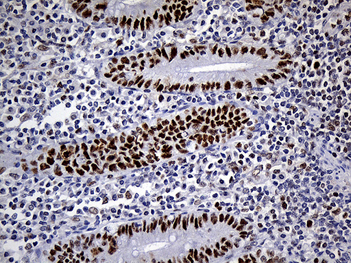 RB1 / Retinoblastoma / RB Antibody - Immunohistochemical staining of paraffin-embedded Human appendix tissue within the normal limits using anti-RB1 mouse monoclonal antibody. (Heat-induced epitope retrieval by 1mM EDTA in 10mM Tris buffer. (pH8.5) at 120°C for 3 min. (1:500)