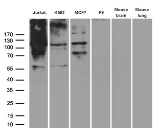 RB1 / Retinoblastoma / RB Antibody - Western blot analysis of extracts. (35ug) from 4 different cell lines and 2 different tissue lysates by using anti-RB1 monoclonal antibody. (1:500)