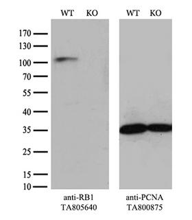 RB1 / Retinoblastoma / RB Antibody - Equivalent amounts of cell lysates  and RB1-Knockout Hela cells  were separated by SDS-PAGE and immunoblotted with anti-RB1 monoclonal antibody. Then the blotted membrane was stripped and reprobed with anti-PCNA antibody as a loading control.