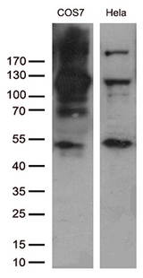 RB1 / Retinoblastoma / RB Antibody - Western blot analysis of extracts. (35ug) from 2 different cell lines by using anti-RB1 monoclonal antibody. 1:400