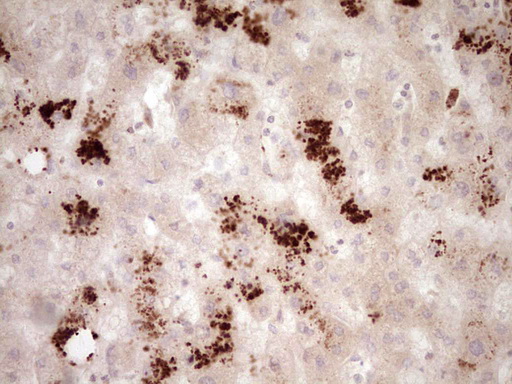 RB1 / Retinoblastoma / RB Antibody - Immunohistochemical staining of paraffin-embedded Human liver tissue within the normal limits using anti-RB1 mouse monoclonal antibody. (Heat-induced epitope retrieval by 1 mM EDTA in 10mM Tris, pH8.5, 120C for 3min,