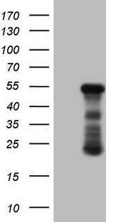 RB1 / Retinoblastoma / RB Antibody - Human recombinant protein fragment corresponding to amino acids 309-590 of human RB1(NP_000312) produced in E.coli.