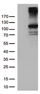 RB1 / Retinoblastoma / RB Antibody - Human recombinant protein fragment corresponding to amino acids 309-590 of human RB1(NP_000312) produced in E.coli.