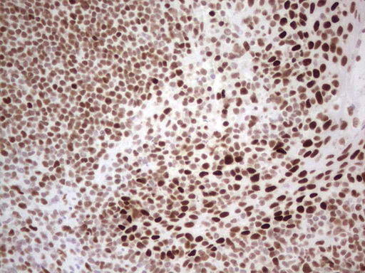 RB1 / Retinoblastoma / RB Antibody - Immunohistochemical staining of paraffin-embedded Human tonsil within the normal limits using anti-RB1 mouse monoclonal antibody. (Heat-induced epitope retrieval by 1 mM EDTA in 10mM Tris, pH8.5, 120C for 3min,