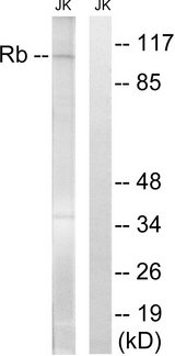 RB1 / Retinoblastoma / RB Antibody - Western blot analysis of lysates from Jurkat cells, treated with PMA 125ng/ml 30', using Retinoblastoma Antibody. The lane on the right is blocked with the synthesized peptide.