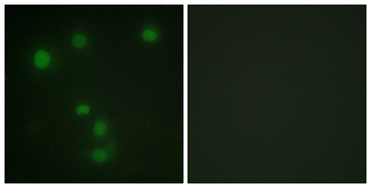 RB1 / Retinoblastoma / RB Antibody - Immunofluorescence analysis of HUVEC cells, using Retinoblastoma Antibody. The picture on the right is blocked with the synthesized peptide.