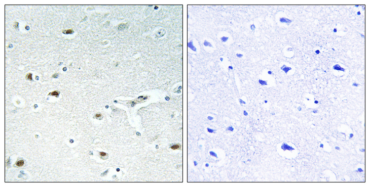 RB1 / Retinoblastoma / RB Antibody - Immunohistochemistry analysis of paraffin-embedded human brain tissue, using Retinoblastoma Antibody. The picture on the right is blocked with the synthesized peptide.