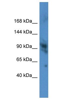 RB1 / Retinoblastoma / RB Antibody - RB1 / Retinoblastoma / RB antibody Western Blot of Mouse Heart. Antibody dilution: 1 ug/ml.  This image was taken for the unconjugated form of this product. Other forms have not been tested.