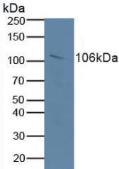 RB1 / Retinoblastoma / RB Antibody - Western Blot; Sample: Human Serum.