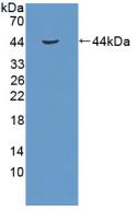 RB1 / Retinoblastoma / RB Antibody - Western Blot; Sample: Recombinant RB1, Human.