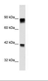 RB1 / Retinoblastoma / RB Antibody - Daudi Cell Lysate.  This image was taken for the unconjugated form of this product. Other forms have not been tested.